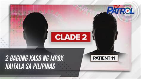 2 bagong kaso ng mpox naitala sa Pilipinas .